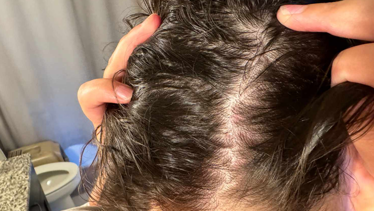 Essential Scalp Treatments for Stronger and Thicker Hair